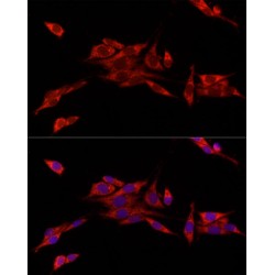 CDGSH Iron Sulfur Domain 1 (CISD1) Antibody