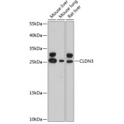Western blot analysis of various lysates using CLDN3 Antibody at 1/3000 dilution. Secondary antibody: HRP-conjugated Goat anti-Rabbit IgG (H+L) at 1/10000 dilution. Lysates/proteins: 25 µg per lane. Blocking buffer: 3% nonfat dry milk in TBST. Exposure time: 20s.