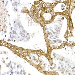 Collagen Type I Alpha 1 (COL1A1) Antibody
