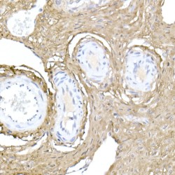 Collagen Type I Alpha 1 (COL1A1) Antibody