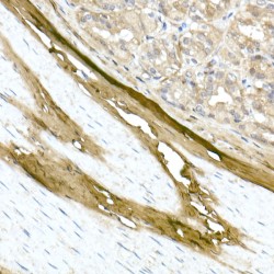 Collagen Type I Alpha 1 (COL1A1) Antibody