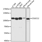 Western blot analysis of various lysates using COLEC12 Antibody at 1/2000 dilution. Secondary antibody: HRP-conjugated Goat anti-Rabbit IgG (H+L) at 1/10000 dilution. Lysates/proteins: 25 µg per lane. Blocking buffer: 3% nonfat dry milk in TBST. Exposure time: 5s.