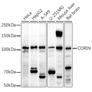 Western blot analysis of various lysates using CORIN Antibody at 1/1000 dilution. Secondary antibody: HRP-conjugated Goat anti-Rabbit IgG (H+L) at 1/10000 dilution. Lysates/proteins: 25 µg per lane. Blocking buffer: 3% nonfat dry milk in TBST. Exposure time: 180s.