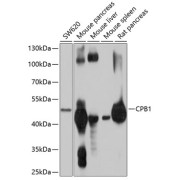 Western blot analysis of various lysates using CPB1 Antibody at 1/1000 dilution. Secondary antibody: HRP-conjugated Goat anti-Rabbit IgG (H+L) at 1/10000 dilution. Lysates/proteins: 25 µg per lane. Blocking buffer: 3% nonfat dry milk in TBST. Exposure time: 5s.