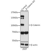 Western blot analysis of lysates from wild type (WT) and β-Catenin knockout (KO) 293T cells, using [KO Validated] β-Catenin Antibody at 1/1000 dilution. Secondary antibody: HRP-conjugated Goat anti-Rabbit IgG (H+L) at 1/10000 dilution. Lysates/proteins: 25 µg per lane. Blocking buffer: 3% nonfat dry milk in TBST. Exposure time: 90s.