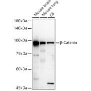 Western blot analysis of various lysates, using β-Catenin Antibody at 1/500 dilution. Secondary antibody: HRP-conjugated Goat anti-Rabbit IgG (H+L) at 1/10000 dilution. Lysates/proteins: 25 µg per lane. Blocking buffer: 3% nonfat dry milk in TBST. Exposure time: 90s.