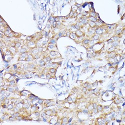 Cathepsin F (CTSF) Antibody