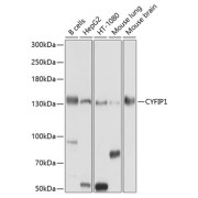 Western blot analysis of various lysates using CYFIP1 Antibody at 1/1000 dilution. Secondary antibody: HRP-conjugated Goat anti-Rabbit IgG (H+L) at 1/10000 dilution. Lysates/proteins: 25 µg per lane. Blocking buffer: 3% nonfat dry milk in TBST. Exposure time: 10s.