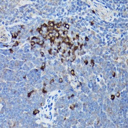 DNA Damage Inducible Transcript 3 (DDIT3) Antibody