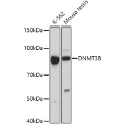 Western blot analysis of various lysates using DNMT3B Antibody at 1/1000 dilution. Secondary antibody: HRP-conjugated Goat anti-Rabbit IgG (H+L) at 1/10000 dilution. Lysates / proteins: 25 µg per lane. Blocking buffer: 3 % nonfat dry milk in TBST. Detection: ECL Basic Kit (RM00020). Exposure time: 30s.