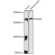 Western blot analysis of various lysates using EGFR Antibody at 1/1000 dilution. Secondary antibody: HRP-conjugated Goat anti-Rabbit IgG (H+L) at 1/10000 dilution. Lysates/proteins: 25 µg per lane. Blocking buffer: 3% nonfat dry milk in TBST. Exposure time: 10s.
