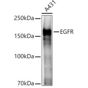 Western blot analysis of lysates from A431 cells, using EGFR Antibody at 1/2000 dilution. Secondary antibody: HRP-conjugated Goat anti-Rabbit IgG (H+L) at 1/10000 dilution. Lysates/proteins: 25 µg per lane. Blocking buffer: 3% nonfat dry milk in TBST. Exposure time: 3s.