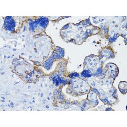 Epidermal Growth Factor Receptor (EGFR) Antibody