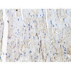 Epidermal Growth Factor Receptor (EGFR) Antibody