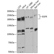 Western blot analysis of various lysates using EGFR Antibody at 1/1000 dilution. Secondary antibody: HRP-conjugated Goat anti-Rabbit IgG (H+L) at 1/10000 dilution. Lysates/proteins: 25 µg per lane. Blocking buffer: 3% nonfat dry milk in TBST. Exposure time: 60s.
