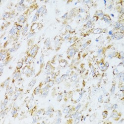 Epidermal Growth Factor Receptor (EGFR) Antibody