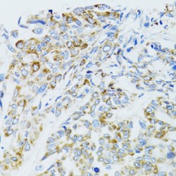 Epidermal Growth Factor Receptor (EGFR) Antibody