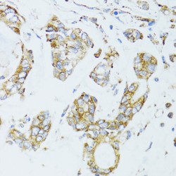Epidermal Growth Factor Receptor (EGFR) Antibody