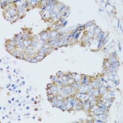 Epidermal Growth Factor Receptor (EGFR) Antibody