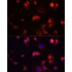 Epidermal Growth Factor Receptor (EGFR) Antibody