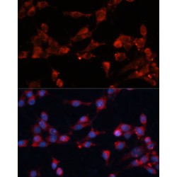 Eukaryotic Translation Initiation Factor 3 Subunit B (EIF3B) Antibody