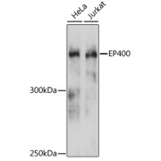 Western blot analysis of various lysates using EP400 Antibody at 1/3000 dilution. Secondary antibody: HRP-conjugated Goat anti-Rabbit IgG (H+L) at 1/10000 dilution. Lysates/proteins: 25 µg per lane. Blocking buffer: 3% nonfat dry milk in TBST. Exposure time: 90s.