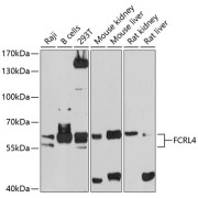 Western blot analysis of various lysates using FCRL4 Antibody at 1/1000 dilution. Secondary antibody: HRP-conjugated Goat anti-Rabbit IgG (H+L) at 1/10000 dilution. Lysates/proteins: 25 µg per lane. Blocking buffer: 3% nonfat dry milk in TBST. Exposure time: 90s.