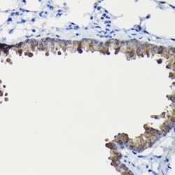 Fucosidase Alpha L2, Plasma (FUCA2) Antibody