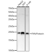 Western blot analysis of various lysates, using FXN / Frataxin Antibody at 1/1000 dilution. Secondary antibody: HRP-conjugated Goat anti-Rabbit IgG (H+L) at 1/10000 dilution. Lysates/proteins: 25 µg per lane. Blocking buffer: 3% nonfat dry milk in TBST. Exposure time: 3s.