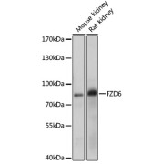 abx125860