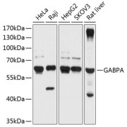 Western blot analysis of various lysates using GABPA Antibody at 1/1000 dilution. Secondary antibody: HRP-conjugated Goat anti-Rabbit IgG (H+L) at 1/10000 dilution. Lysates/proteins: 25 µg per lane. Blocking buffer: 3% nonfat dry milk in TBST. Exposure time: 1s.