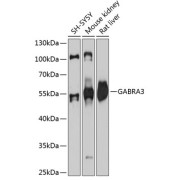 Western blot analysis of various lysates using GABRA3 Antibody at 1/3000 dilution. Secondary antibody: HRP-conjugated Goat anti-Rabbit IgG (H+L) at 1/10000 dilution. Lysates/proteins: 25 µg per lane. Blocking buffer: 3% nonfat dry milk in TBST. Exposure time: 30s.
