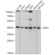 Western blot analysis of various lysates using GIPC1 Antibody at 1/3000 dilution. Secondary antibody: HRP-conjugated Goat anti-Rabbit IgG (H+L) at 1/10000 dilution. Lysates/proteins: 25 µg per lane. Blocking buffer: 3% nonfat dry milk in TBST. Exposure time: 10s.