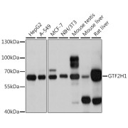 Western blot analysis of various lysates using GTF2H1 Antibody at 1/1000 dilution. Secondary antibody: HRP-conjugated Goat anti-Rabbit IgG (H+L) at 1/10000 dilution. Lysates/proteins: 25 µg per lane. Blocking buffer: 3% nonfat dry milk in TBST. Exposure time: 1s.