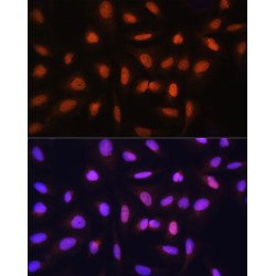 General Transcription Factor IIH, Polypeptide 1 (GTF2H1) Antibody