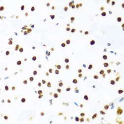 Histone H2A.X (H2AFX) Antibody