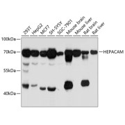 Western blot analysis of various lysates using HEPACAM Antibody at 1/3000 dilution. Secondary antibody: HRP-conjugated Goat anti-Rabbit IgG (H+L) at 1/10000 dilution. Lysates/proteins: 25 µg per lane. Blocking buffer: 3% nonfat dry milk in TBST. Exposure time: 10s.