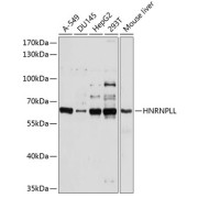 Western blot analysis of various lysates using HNRPLL Antibody at 1/1000 dilution. Secondary antibody: HRP-conjugated Goat anti-Rabbit IgG (H+L) at 1/10000 dilution. Lysates/proteins: 25 µg per lane. Blocking buffer: 3% nonfat dry milk in TBST. Exposure time: 30s.