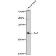 Western blot analysis of lysates from mouse brain, using HRAS Antibody at 1/3000 dilution. Secondary antibody: HRP-conjugated Goat anti-Rabbit IgG (H+L) at 1/10000 dilution. Lysates/proteins: 25 µg per lane. Blocking buffer: 3% nonfat dry milk in TBST. Exposure time: 90s.