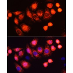 GTPase HRas (HRAS) Antibody