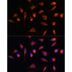 Heat Shock Factor 2-Binding Protein (HSF2BP) Antibody