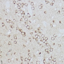 Endoplasmic Reticulum Chaperone BiP (HSPA5) Antibody