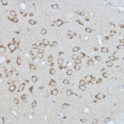 Endoplasmic Reticulum Chaperone BiP (HSPA5) Antibody