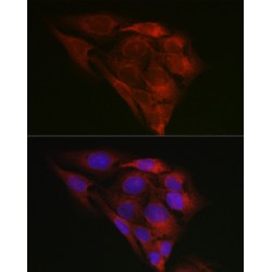 Endoplasmic Reticulum Chaperone BiP (HSPA5) Antibody