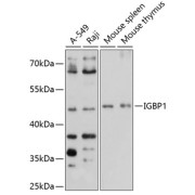 Western blot analysis of various lysates using IGBP1 Antibody at 1/1000 dilution. Secondary antibody: HRP-conjugated Goat anti-Rabbit IgG (H+L) at 1/10000 dilution. Lysates/proteins: 25 µg per lane. Blocking buffer: 3% nonfat dry milk in TBST. Exposure time: 40s.