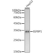 Western blot analysis of lysates from HepG2 cells, using IGFBP1 Antibody at 1/1000 dilution. Secondary antibody: HRP-conjugated Goat anti-Rabbit IgG (H+L) at 1/10000 dilution. Lysates/proteins: 25 µg per lane. Blocking buffer: 3% nonfat dry milk in TBST. Exposure time: 3s.