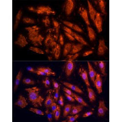 Interleukin 17C (IL17C) Antibody