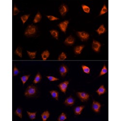 Interleukin 17C (IL17C) Antibody