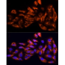 Interleukin 17C (IL17C) Antibody