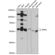 Western blot analysis of various lysates using IP6K1 Antibody at 1/1000 dilution. Secondary antibody: HRP-conjugated Goat anti-Rabbit IgG (H+L) at 1/10000 dilution. Lysates/proteins: 25 µg per lane. Blocking buffer: 3% nonfat dry milk in TBST. Exposure time: 10s.